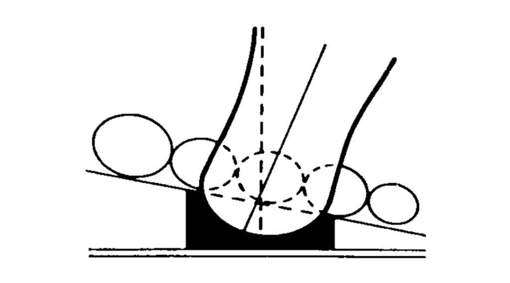 Orthotic Posting Allied OSI Labs